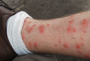 Dedetizadora de pulgas em Perus